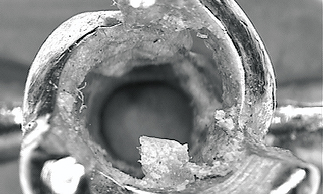 Microscopic view of dead skin cells trapped in a ring